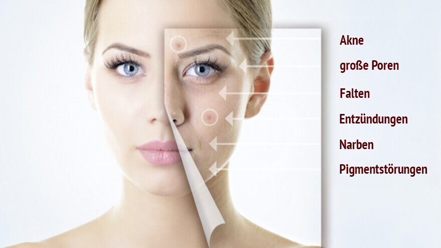 Gesicht einer Frau mit reiner Haut und künstlicher Einblendung von Hautunreinheiten